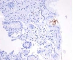 Catalase Mouse anti-H. Pylori, Clone: HPYL/7170, Novus Biologicals:Antibodies:Primary